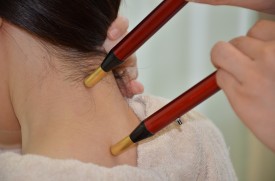 <span style="font-size:70%;">微弱電流療法（アキュスコープキャリー）</span>